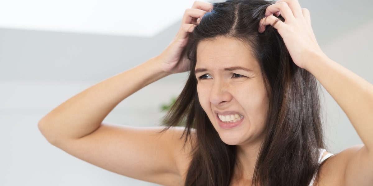 Psorijaza kože glave