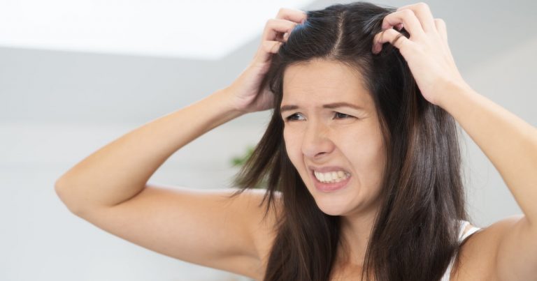 Woman having a bad hair day Psorijaza kože glave
