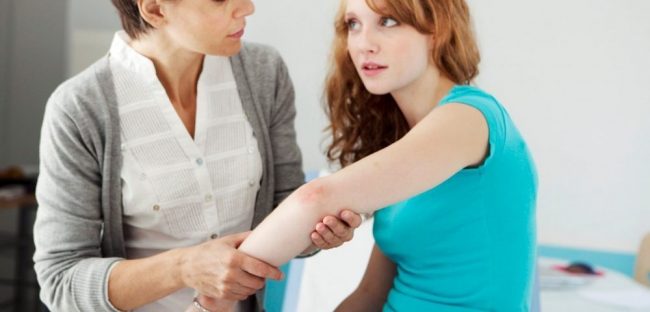 Psorijaza prirodno lečenje