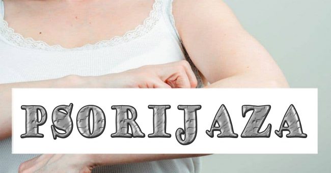 psorijaza Psorijaza - uzroci i terapija