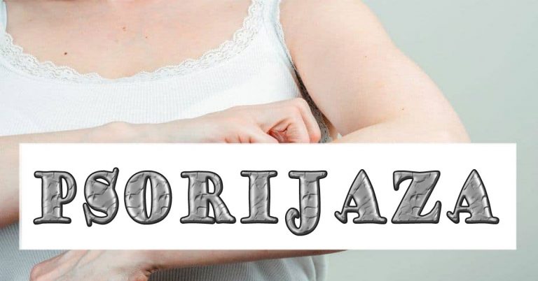 psorijaza Psorijaza - uzroci i terapija