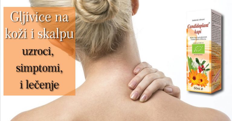 Gljivice-na-koži-i-skalpu—uzroci,-simptomi-i-lecenje