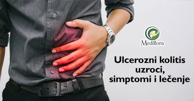 Ulcerozni-kolitis-zapaljenska-bolest-creva—uzroci,-simptomi-i-lecenje Ulcerozni kolitis (zapaljenska bolest creva) - uzroci, simptomi i lečenje