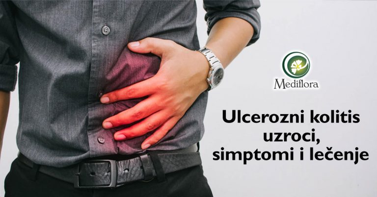 Ulcerozni-kolitis-zapaljenska-bolest-creva—uzroci,-simptomi-i-lecenje Ulcerozni kolitis (zapaljenska bolest creva) - uzroci, simptomi i lečenje