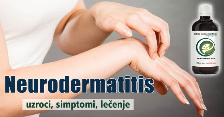 Neurodermatitis—uzroci,-simptomi,-lecenje
