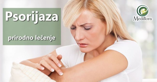 Psorijaza—prirodno-lecenje Psorijaza - prirodno lečenje