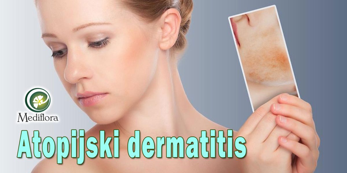 Atopijski-dermatitis—šta-pogoršava-ovo-stanje-kože