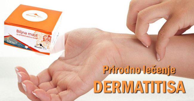Prirodno-lecenje-dermatitisa