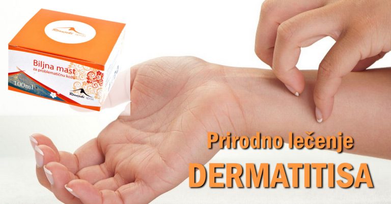 Prirodno-lecenje-dermatitisa