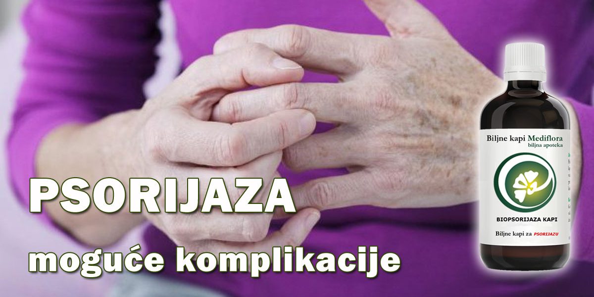 Psorijaza—moguce-komplikacije Psorijaza - moguće komplikacije
