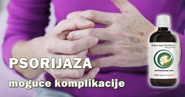 Psorijaza—moguce-komplikacije Psorijaza - moguće komplikacije
