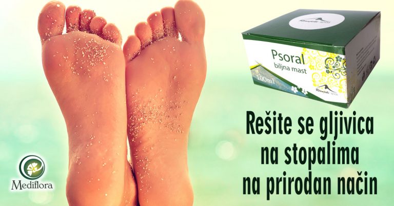 Rešite-se-gljivica-na-stopalima-na-prirodan-nacin Rešite se gljivica na stopalima na prirodan način