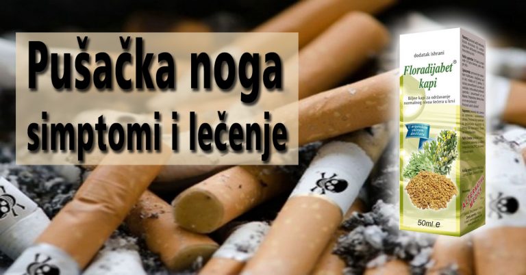 Pušacka-noga—simptomi-i-lecenje