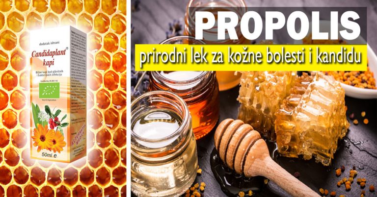 Propolis—prirodni-lek-za-kožne-bolesti-i-kandidu Propolis - prirodni lek za kožne bolesti i kandidu