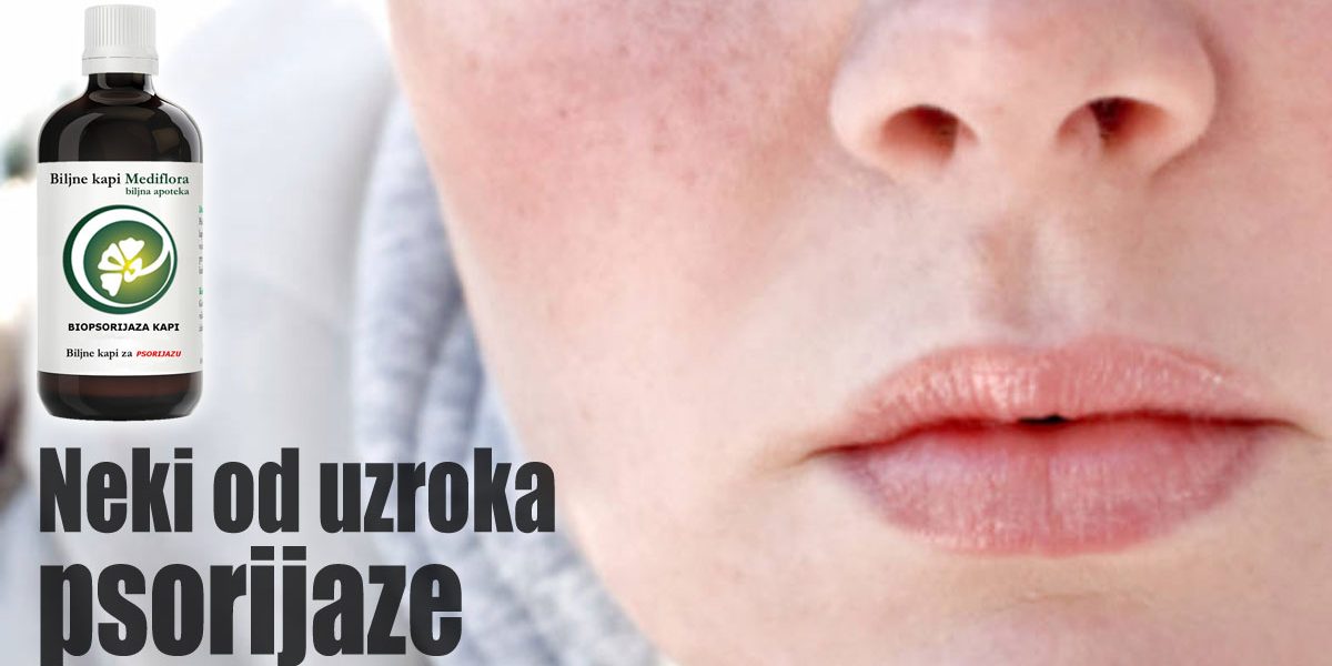 Neki od uzroka psorijaze