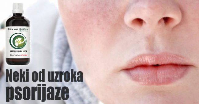 Neki-od-uzroka-psorijaze Neki od uzroka psorijaze