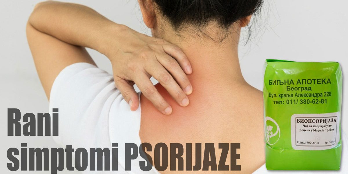 Rani-simptomi-psorijaze Rani simptomi psorijaze