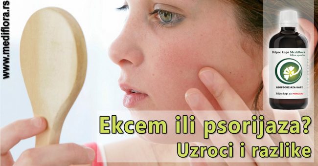 Ekcem-ili-psorijaza-Uzroci-i-razlike Ekcem ili psorijaza? Uzroci i razlike