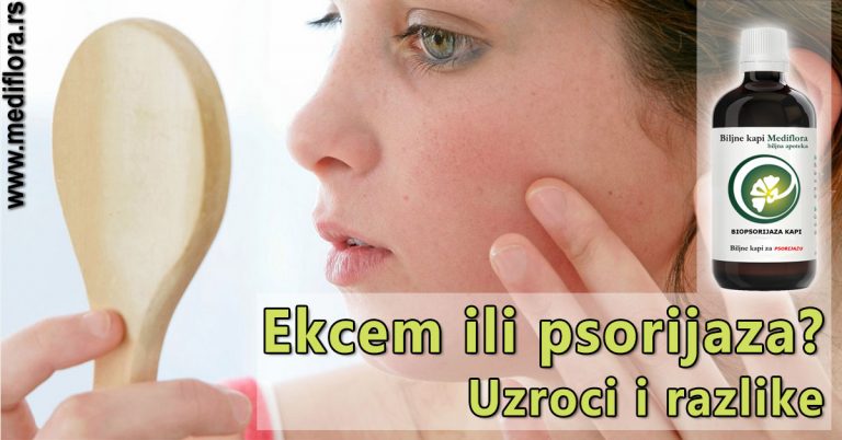 Ekcem-ili-psorijaza-Uzroci-i-razlike Ekcem ili psorijaza? Uzroci i razlike
