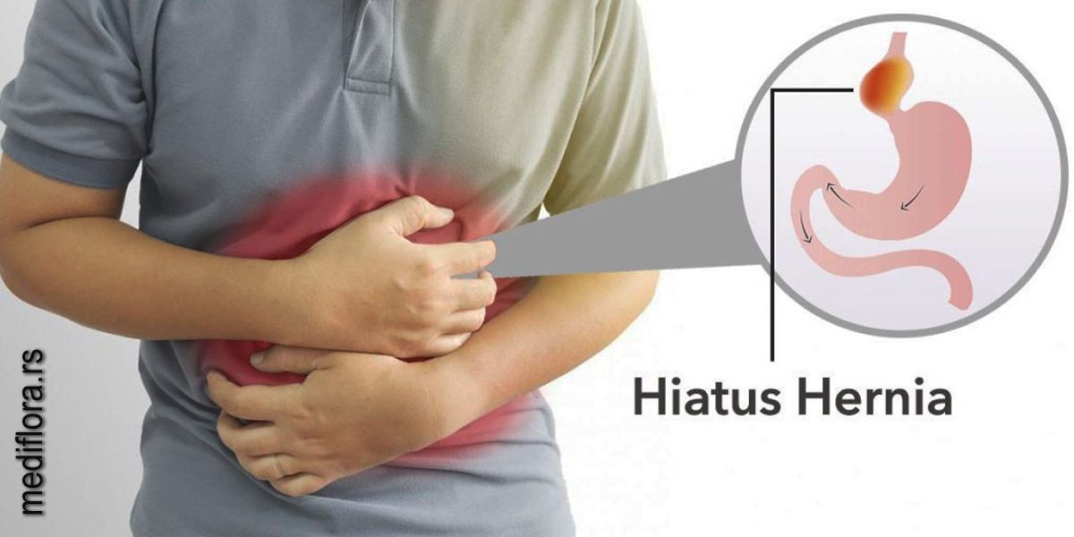 Hijatus hernija - Mediflora