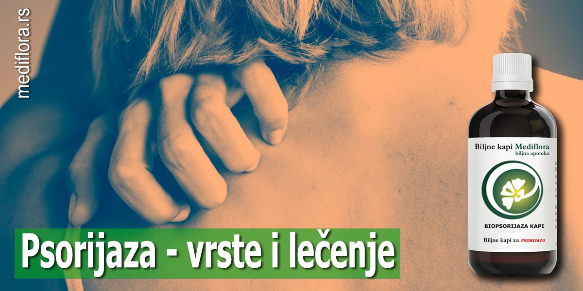 Psorijaza—vrste-i-lečenje Psorijaza - vrste i lečenje