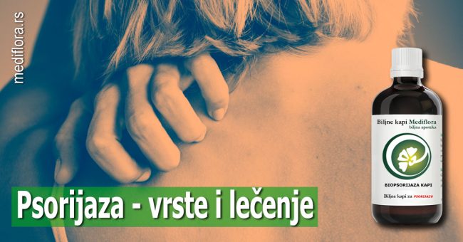 Psorijaza—vrste-i-lečenje Psorijaza - vrste i lečenje