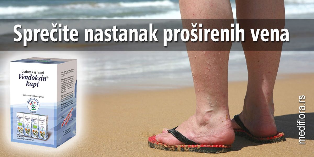 Sprečite-nastanak-proširenih-vena Sprečite nastanak proširenih vena