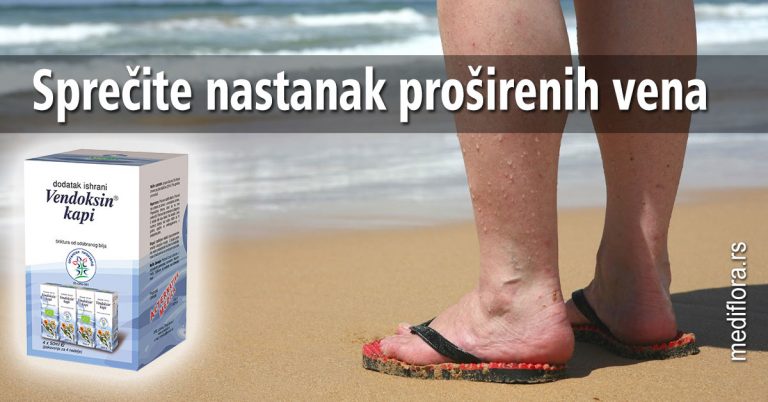 Sprečite nastanak proširenih vena
