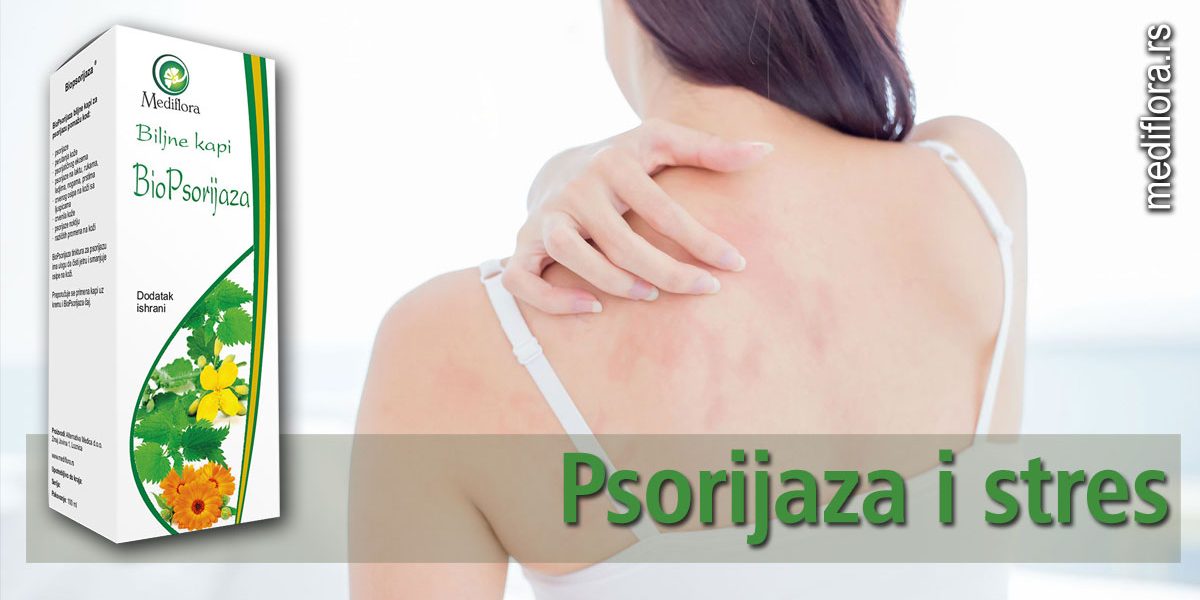 Psorijaza-i-stres Psorijaza i stres