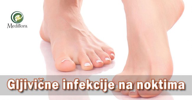Gljivične infekcije na noktima