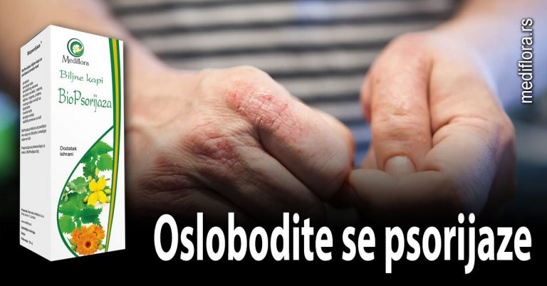 Oslobodite-se-psorijaze