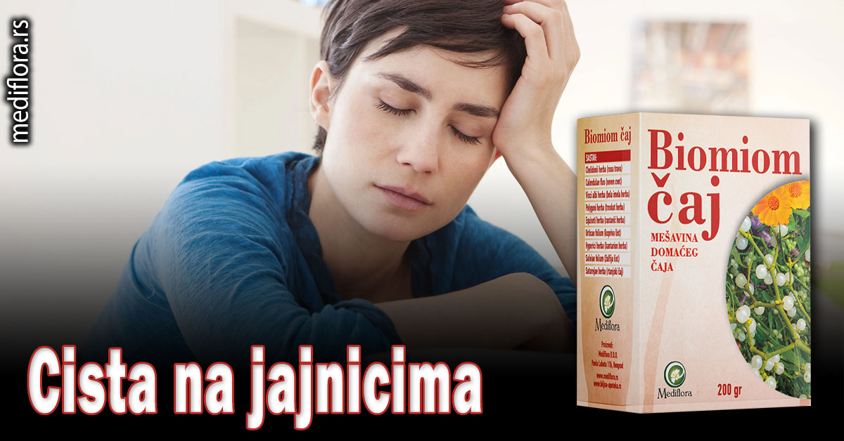 Cista na jajnicima - Mediflora