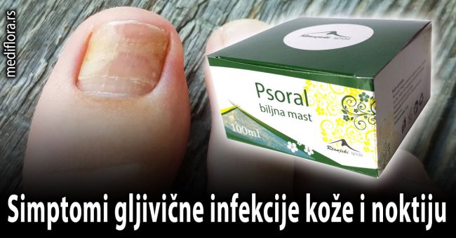 gljivične infekcije