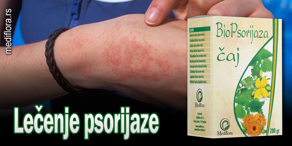 Lečenje psorijaze - Mediflora