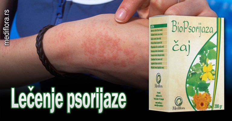Lečenje-psorijaze Lečenje psorijaze
