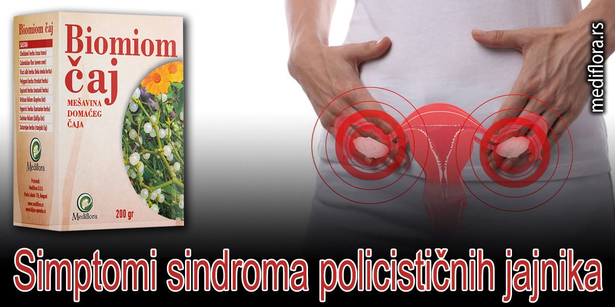 Simptomi-sindroma-policističnih-jajnika Simptomi sindroma policističnih jajnika