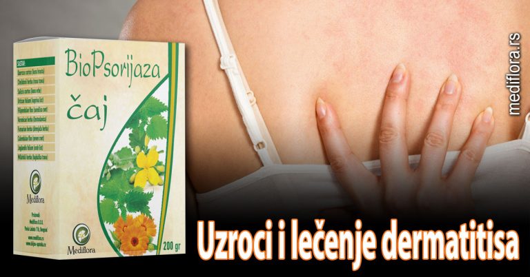 Uzroci-i-lečenje-dermatitisa lečenje dermatitisa