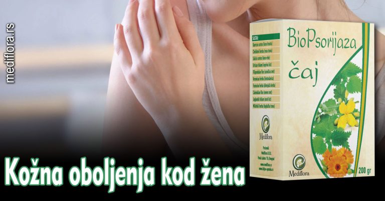 Kožna-oboljenja-kod-žena Kožna oboljenja kod žena