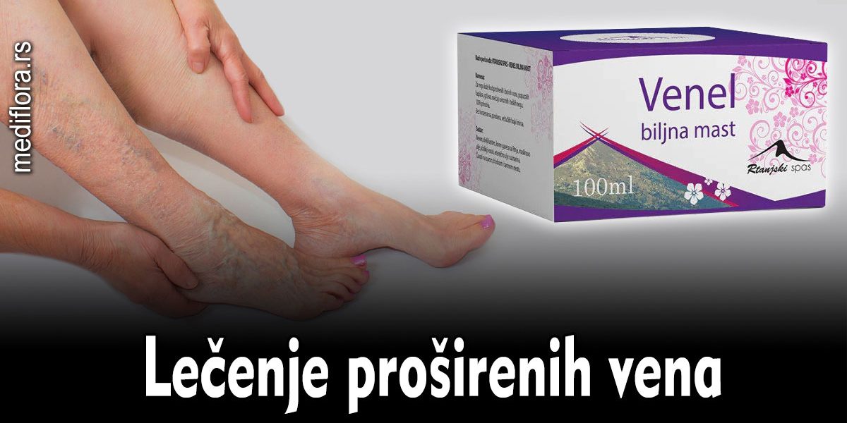 Lečenje proširenih vena