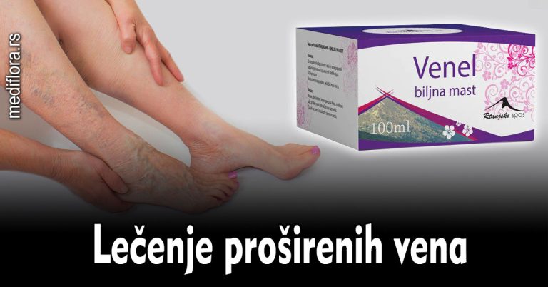 Lečenje-proširenih-vena Lečenje proširenih vena