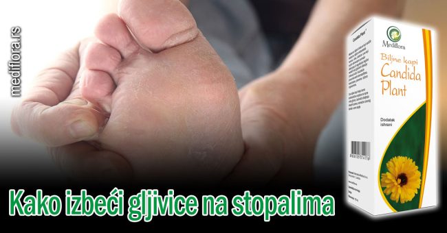 Kako-izbeći-gljivice-na-stopalima Kako izbeći gljivice na stopalima
