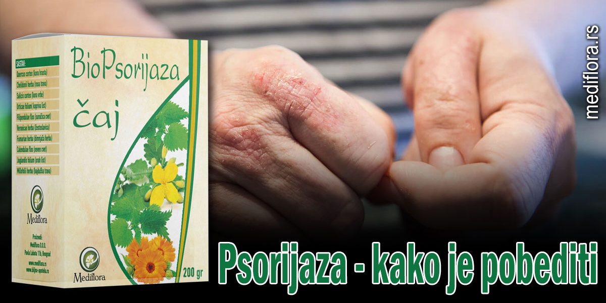 Psorijaza—kako-je-pobediti Psorijaza - kako je pobediti