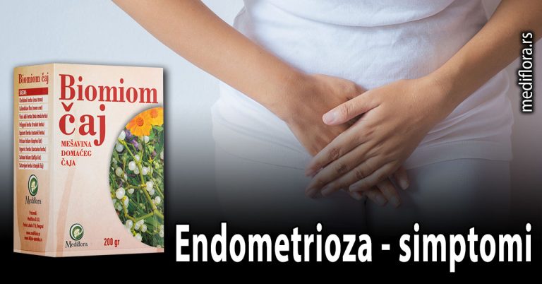 Endometrioza—simptomi Endometrioza - simptomi