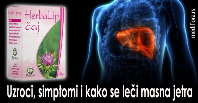 Uzroci,-simptomi-i-kako-se-leči-masna-jetra Uzroci, simptomi i kako se leči masna jetra