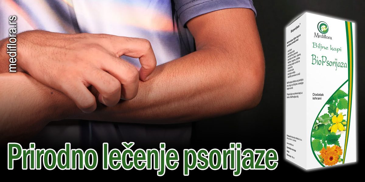 Prirodno lečenje psorijaze
