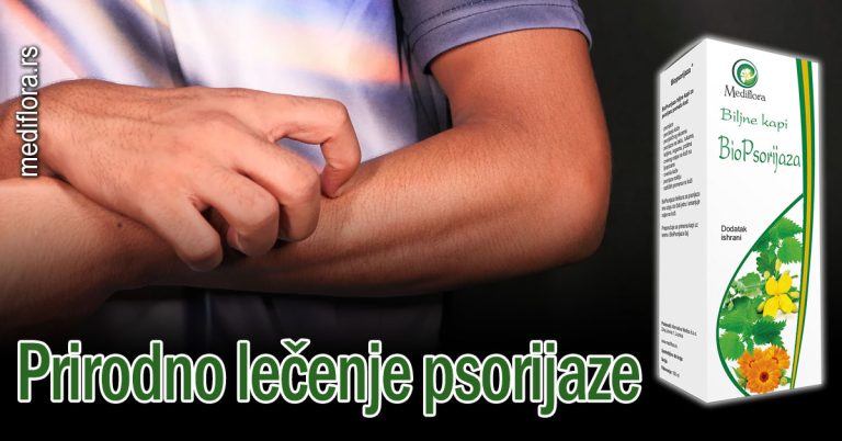 Prirodno-lečenje-psorijaze Prirodno lečenje psorijaze