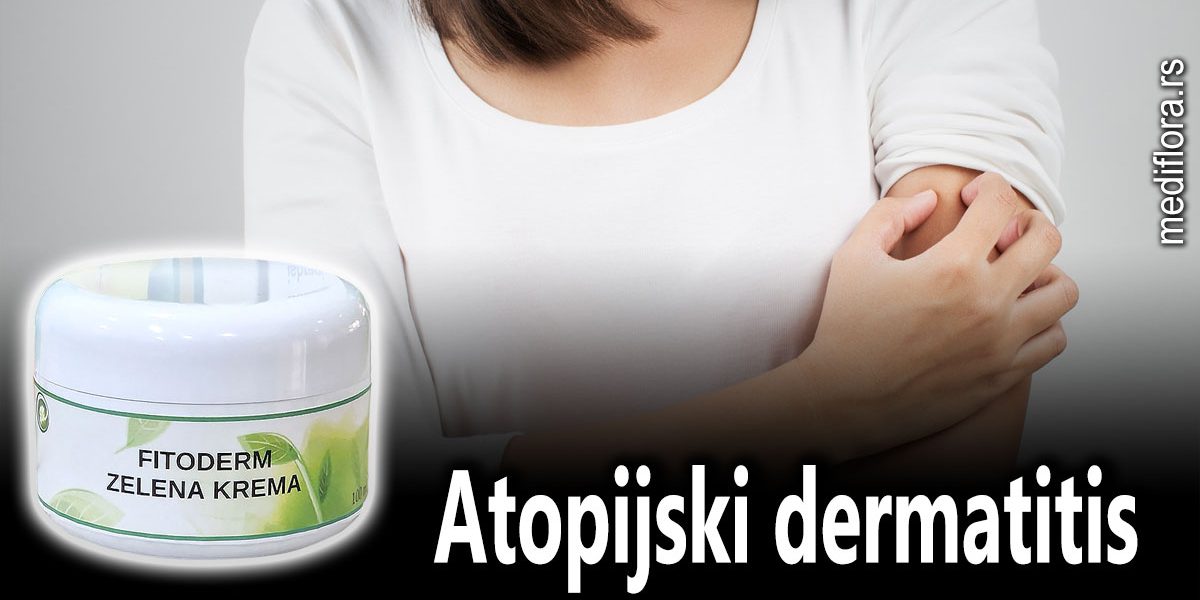 Atopijski-dermatitis Atopijski dermatitis