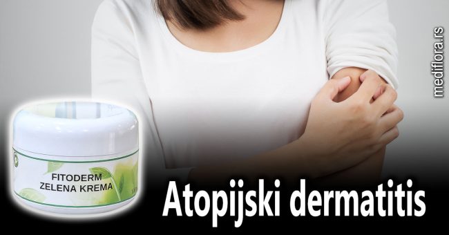 Atopijski-dermatitis Atopijski dermatitis