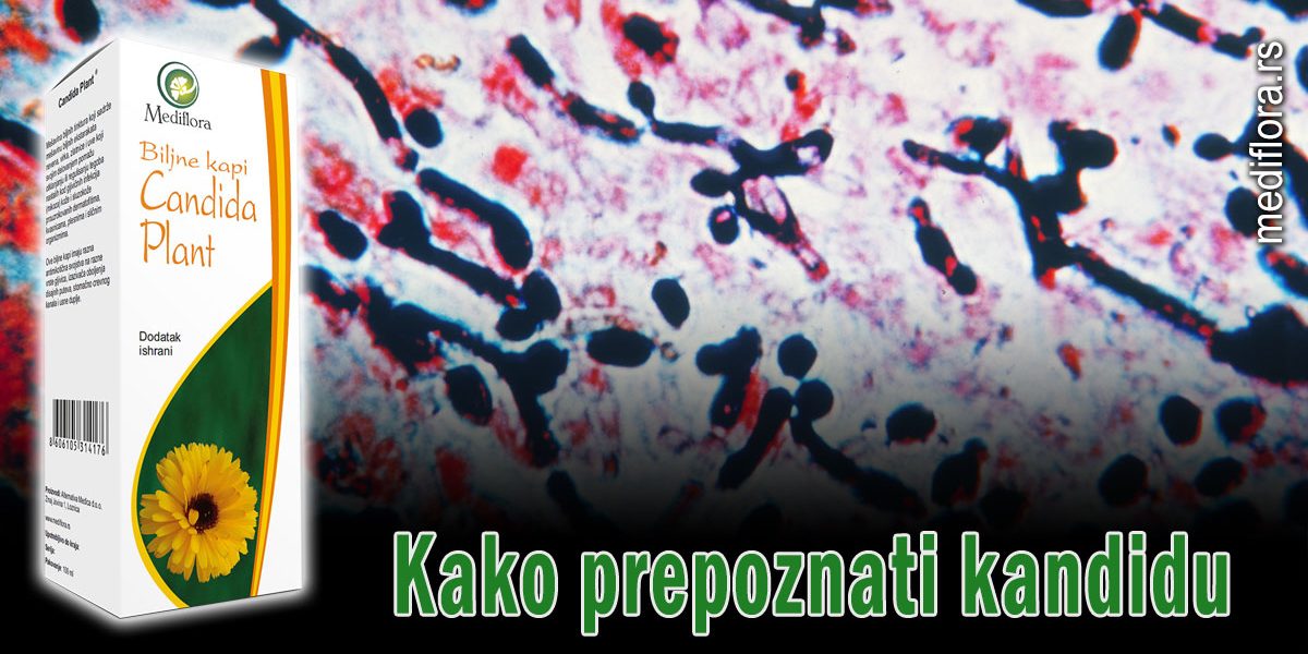 Kako-prepoznati-kandidu Kako prepoznati kandidu