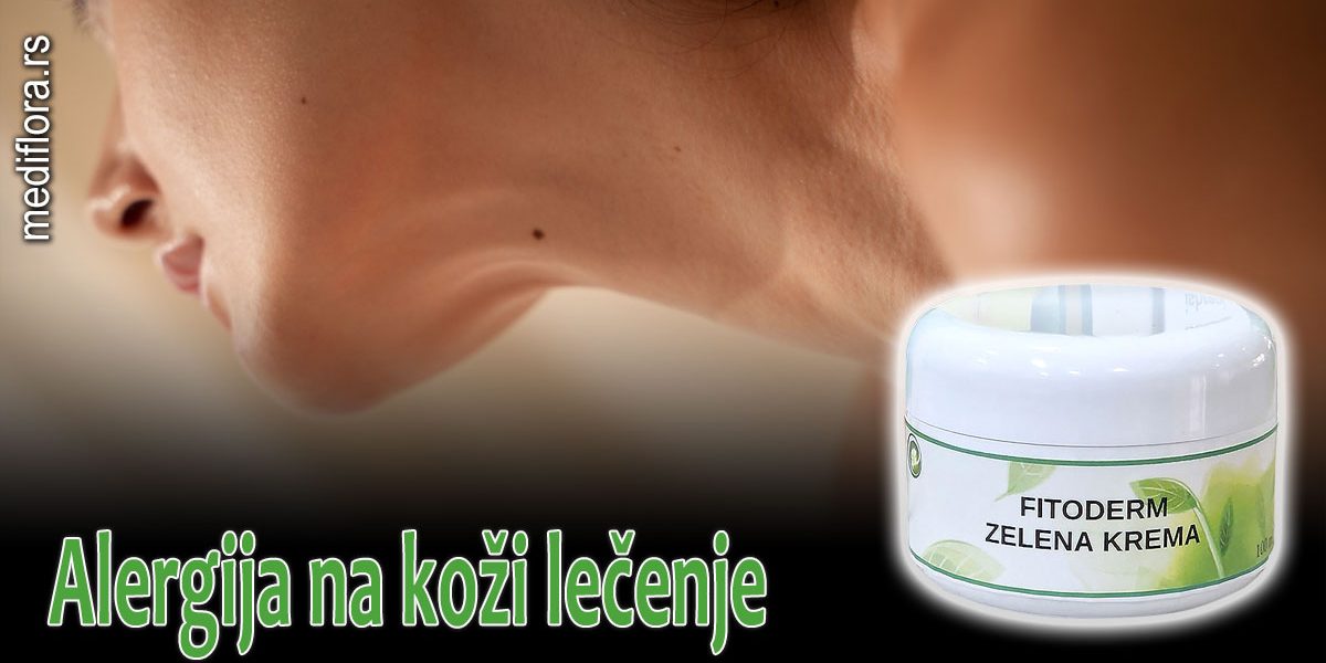 Alergija na koži lečenje